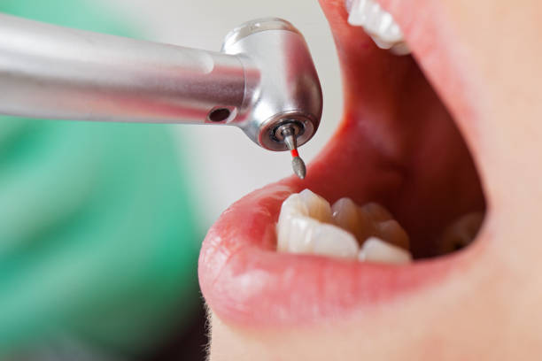 Best Urgent Tooth Repair  in Grundy Center, IA